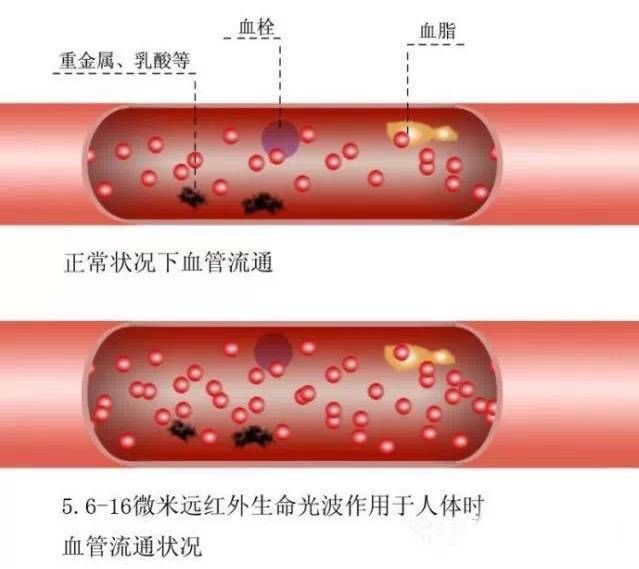 血管是如何一天天堵塞的，看完吓一跳