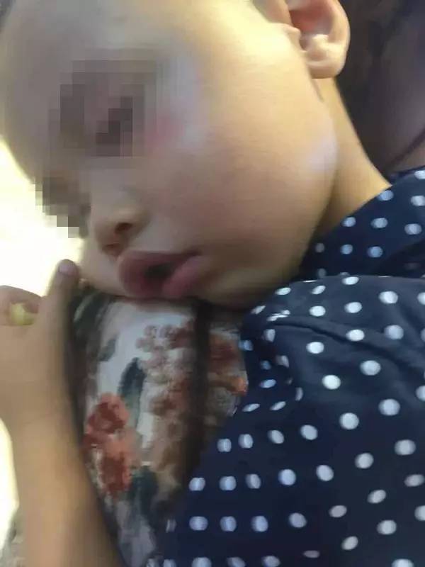 2岁娃店门口被一女子打 当场后脑勺着地鼻子出血 2岁娃店门口被一女子打 当场后脑勺着地鼻子出血