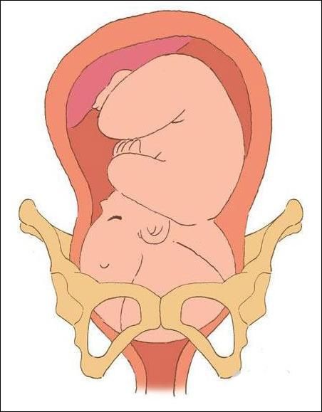 女人生孩子开骨缝一般开多久?