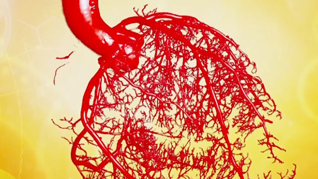 《养生堂》20181102揪出心脏病的准确病因 《养生堂》20181102揪出心脏病的准确病因