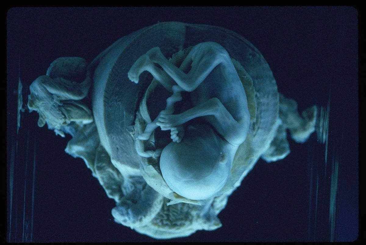 胎儿打嗝和胎动怎么区分?掌握这一点,关系到胎