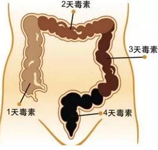一方子5分钟通便,多年便秘没了,体重还瘦了10