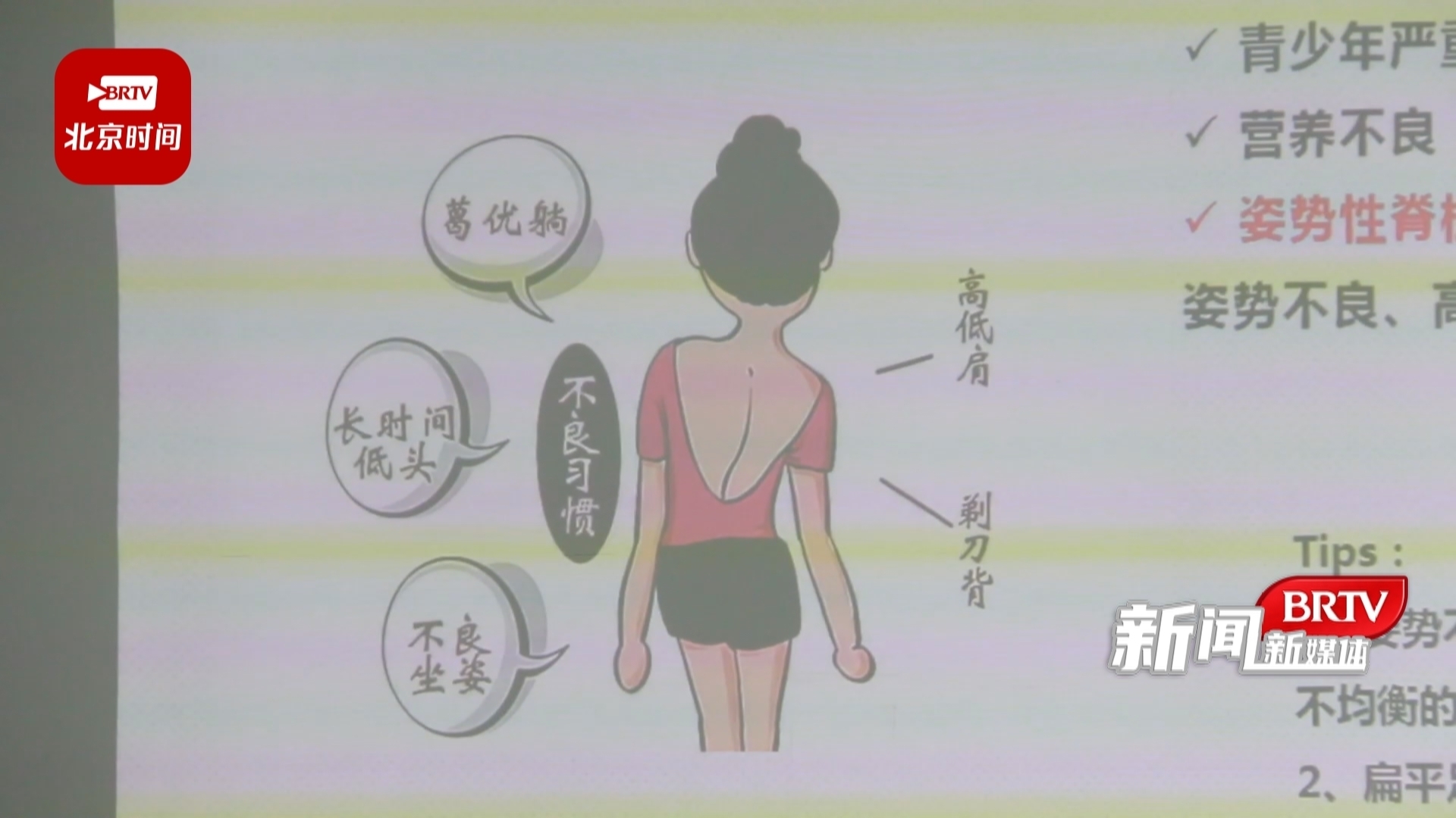 “低头 弯腰 伏案”不可忽视的青少年脊柱侧弯 “低头 弯腰 伏案”不可忽视的青少年脊柱侧弯