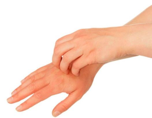 汗疱疹严重吗?找到治疗方法就不严重了