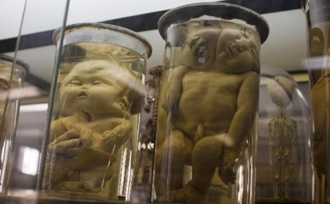 法国博物馆放的吓人罐子,网友:看完肠子悔青