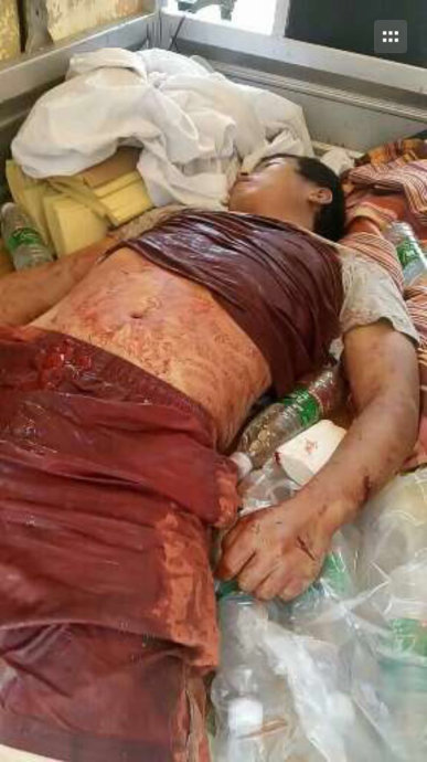 我姐夫的心脏部位被捅了两刀,抢救无效死亡;我姐姐被捅一刀,扎穿肝