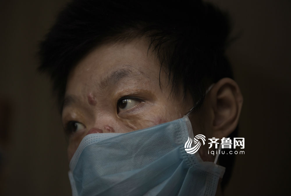 “孩子的毛孔烧没了，一点热气也不能受。”江竹峰说，经过一年多的不间断治疗、手术，她就是想让女儿能活下去。面对记者，平和的情绪下，透露着无法掩饰的哀伤。这个原本幸福的家庭，正在遭受无法被量化的苦与痛。