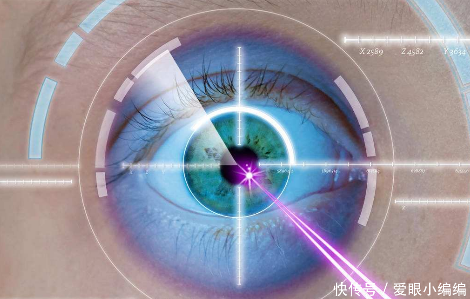 邯郸近视眼激光手术疼不疼?