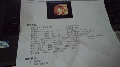 B超照片上的英文名称说明 新手孕妈须知