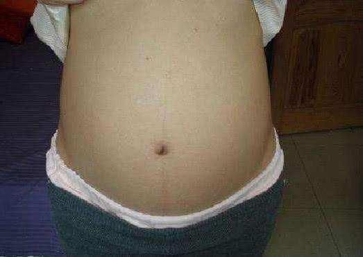 孕妇腹痛不止, 就医后被告知胎儿不保, 孕期不宜