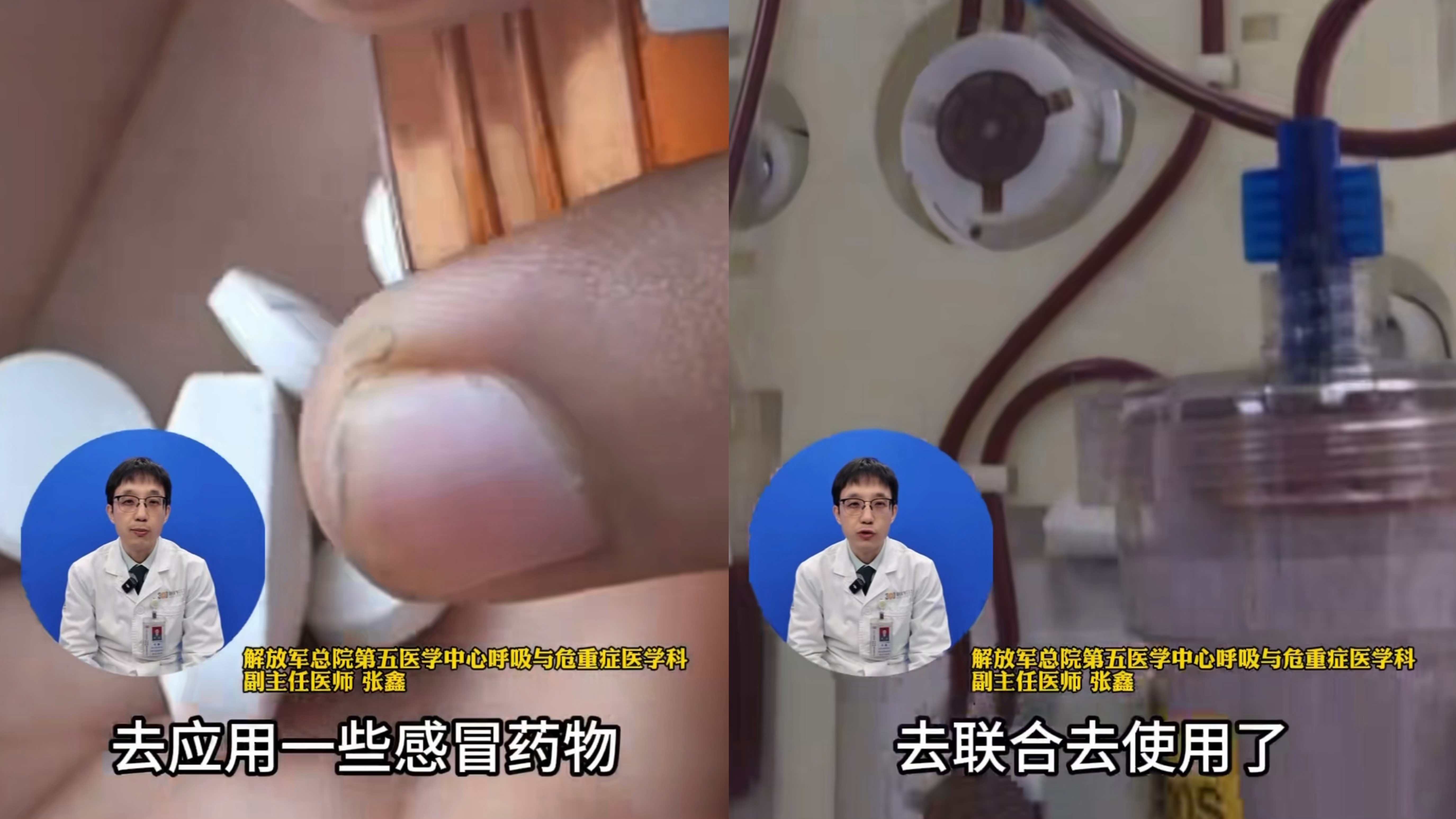 多种感冒药混吃超危险,超剂量服用可能会伤肝 多种感冒药混吃超危险,超剂量服用可能会伤肝