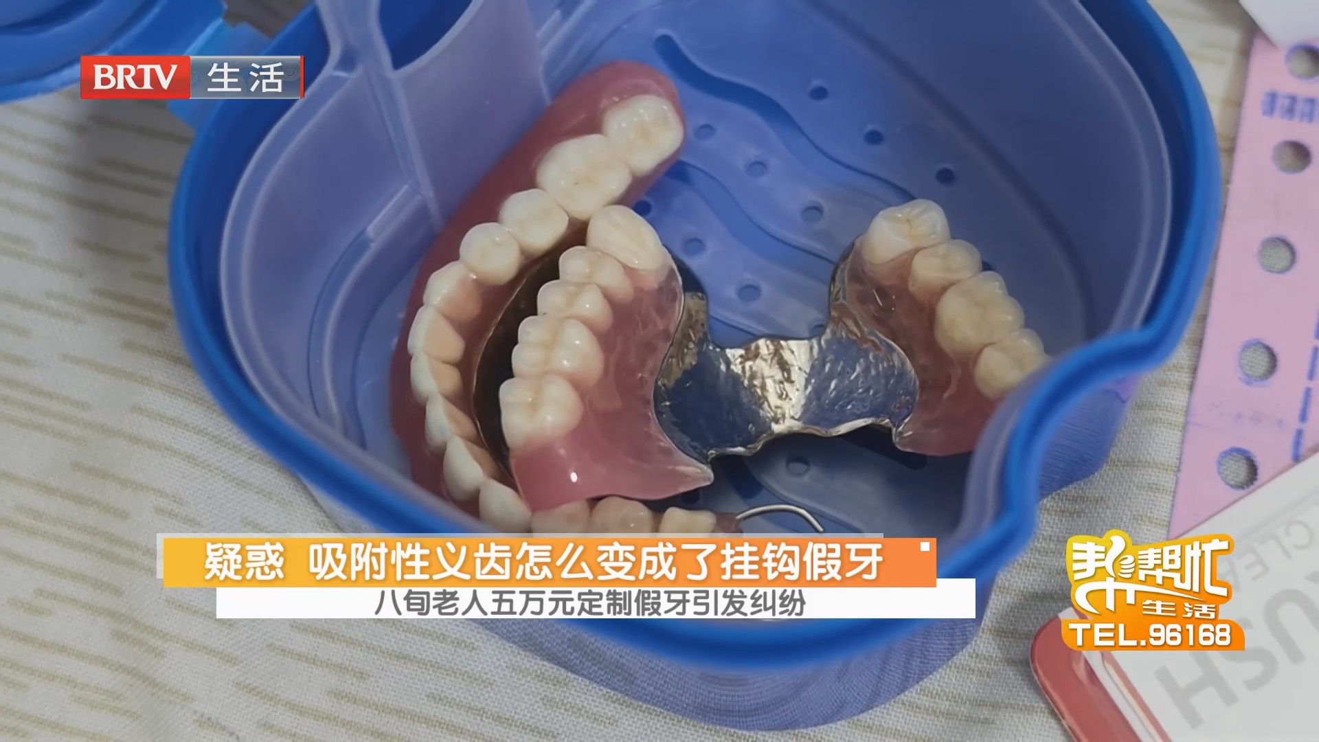 疑惑 吸附性义齿怎么变成了挂钩假牙