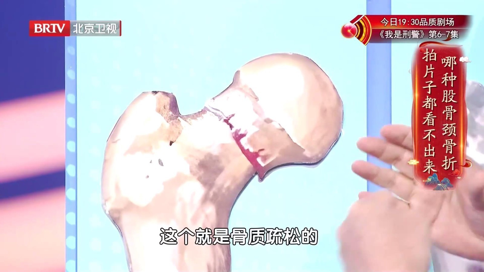 这种股骨颈骨折隐匿性强，拍片子可能都看不出来！