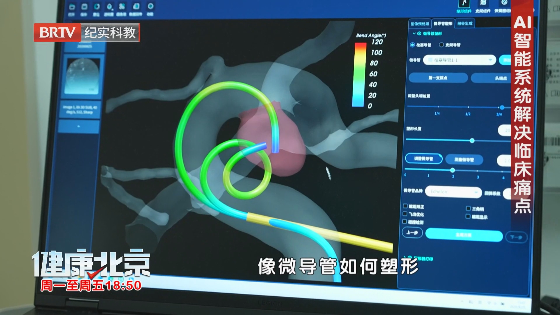 《健康北京》20260915当“不定时炸弹”遇上AI诊疗