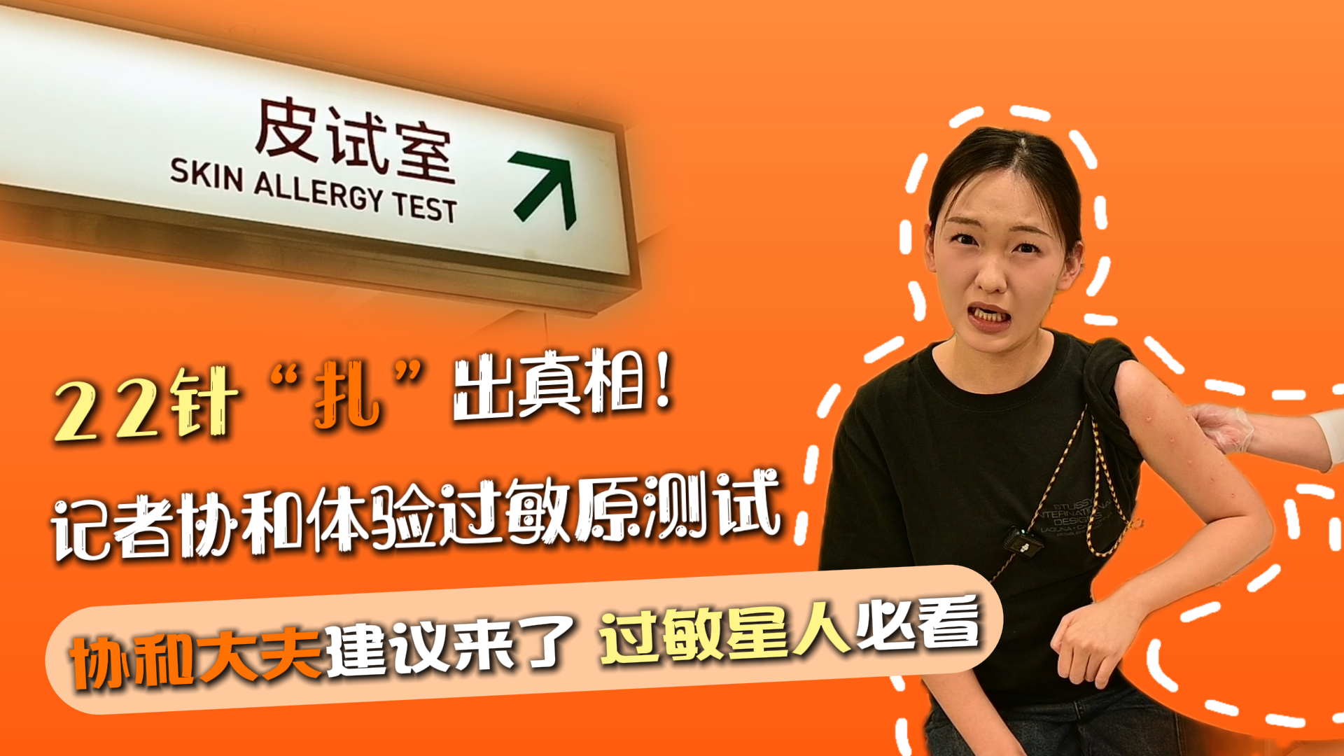 22针“扎”出真相！记者协和医院体验过敏原测试！