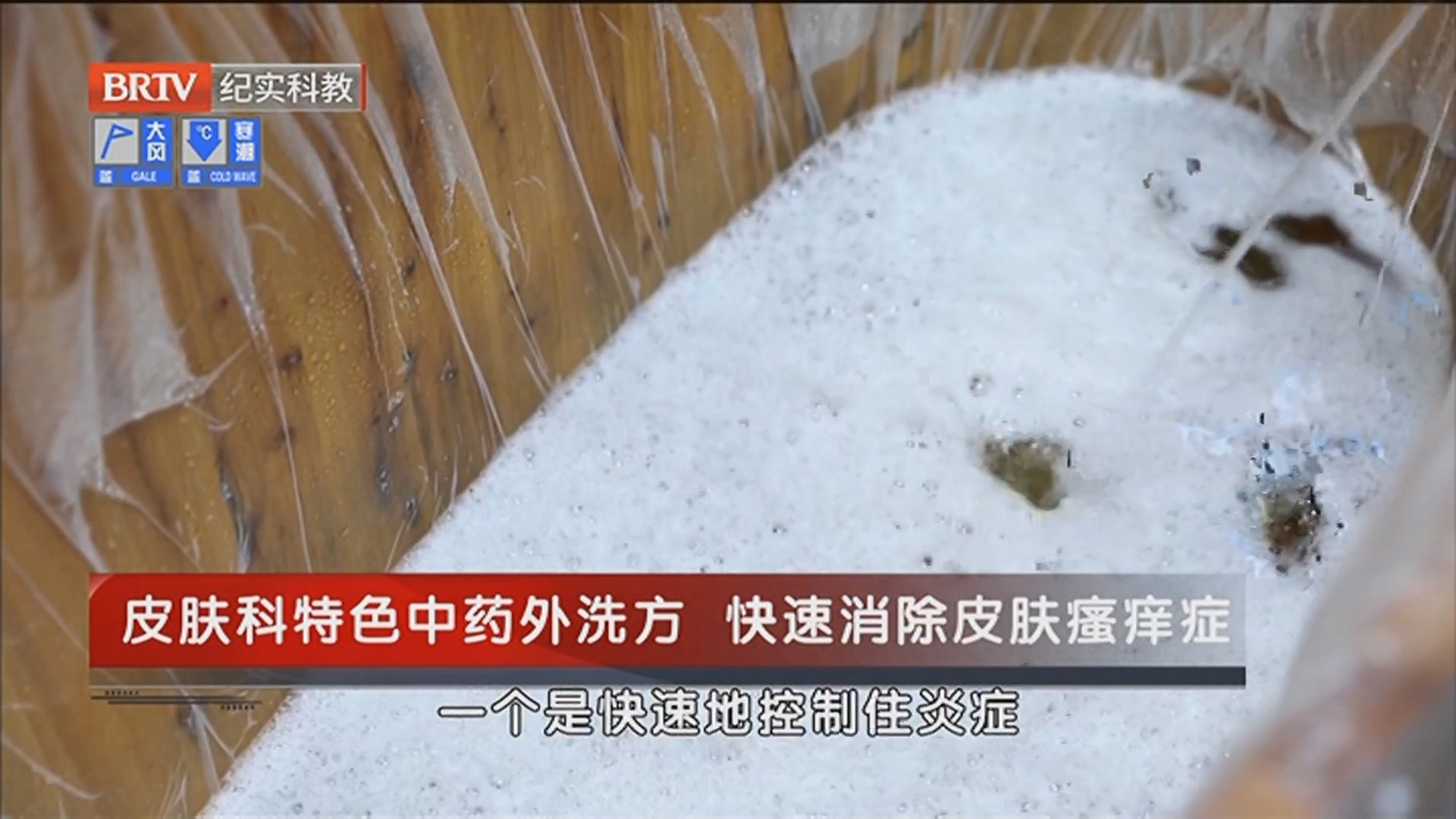 《职场健康说》20251130别让“痒”拖成大病:皮肤瘙痒症的健康警报 《职场健康说》20251130别让“痒”拖成大病:皮肤瘙痒症的健康警报