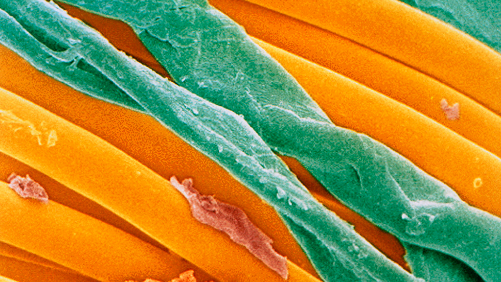 聚酯纤维是用塑料瓶做的，穿了会导致微塑料进入血液？