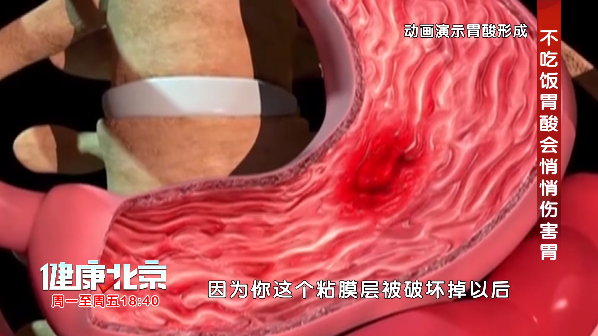 黑便！呕血！你的胃正在濒临崩溃