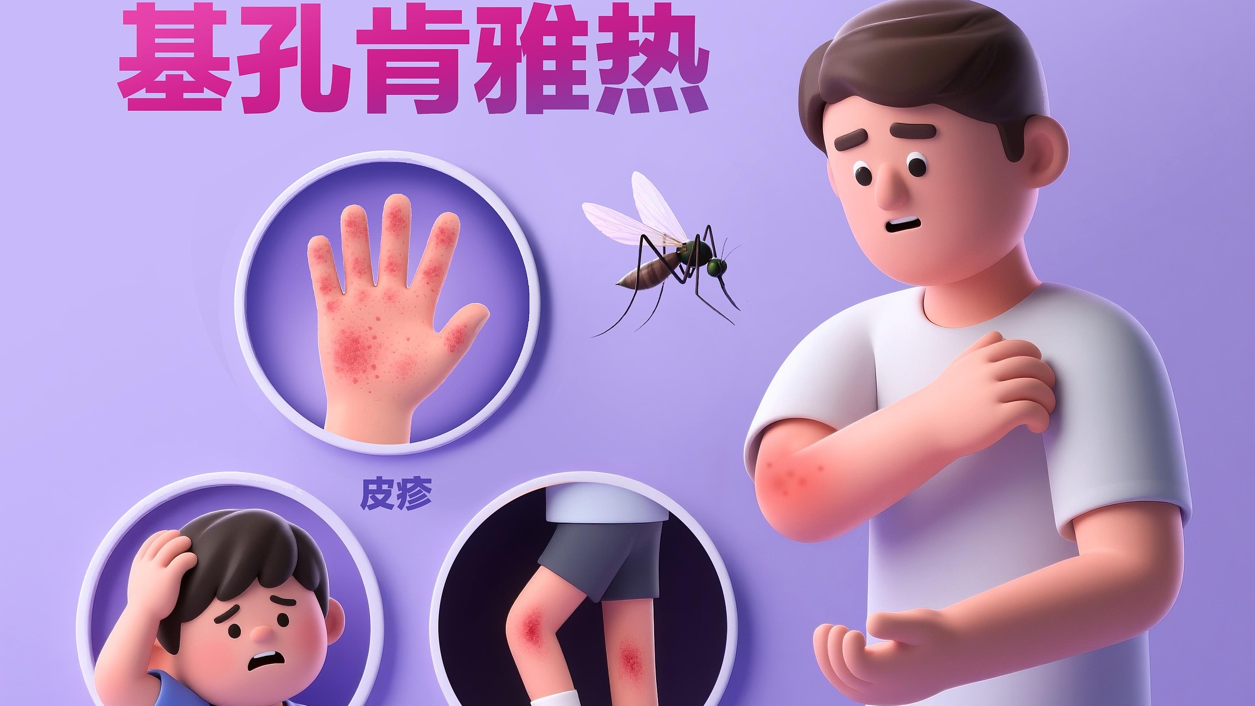 基孔肯雅热的11个关键问题，一次说清→