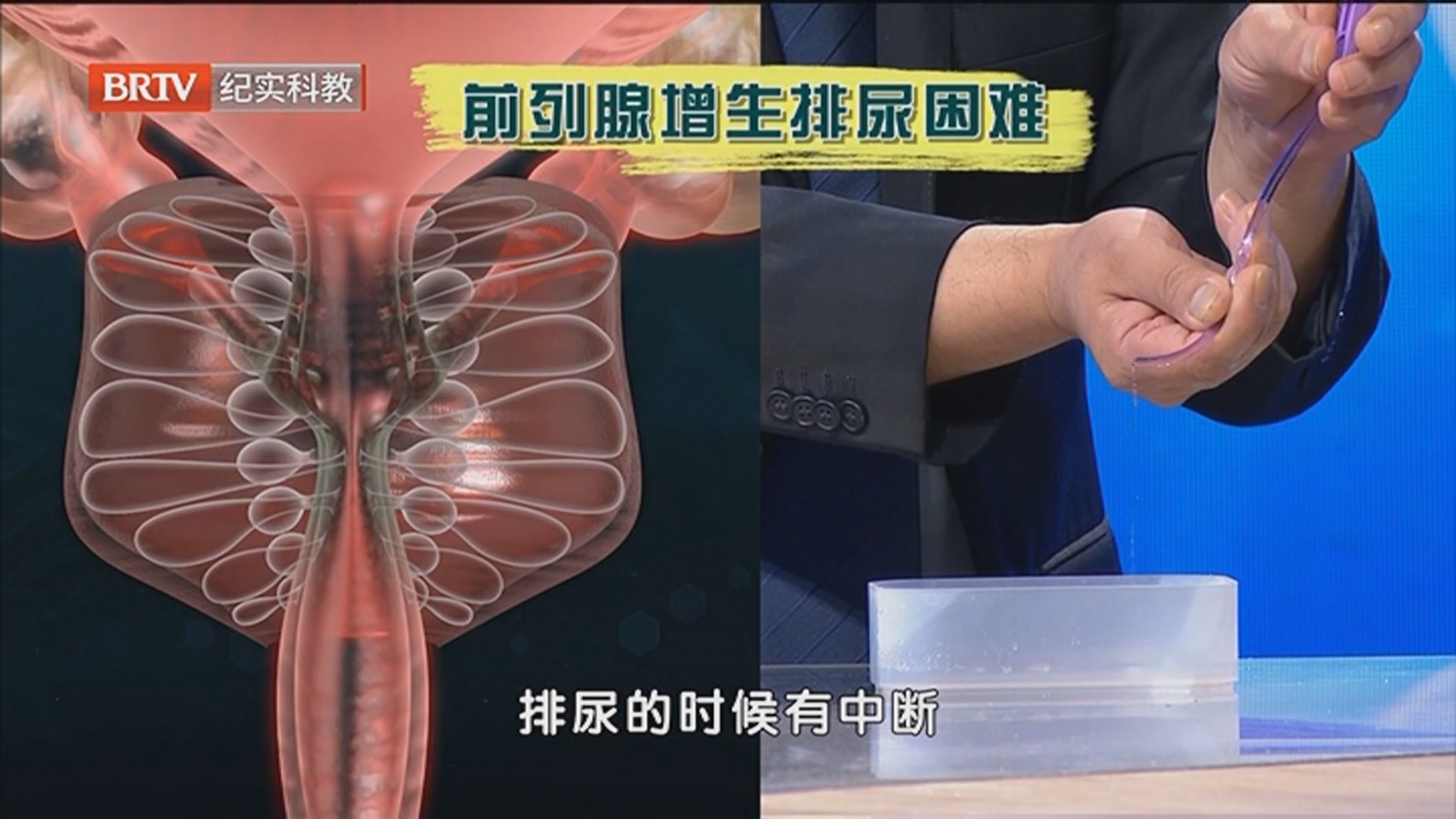 《职场健康说》20260608健康防线：破解前列腺迷局