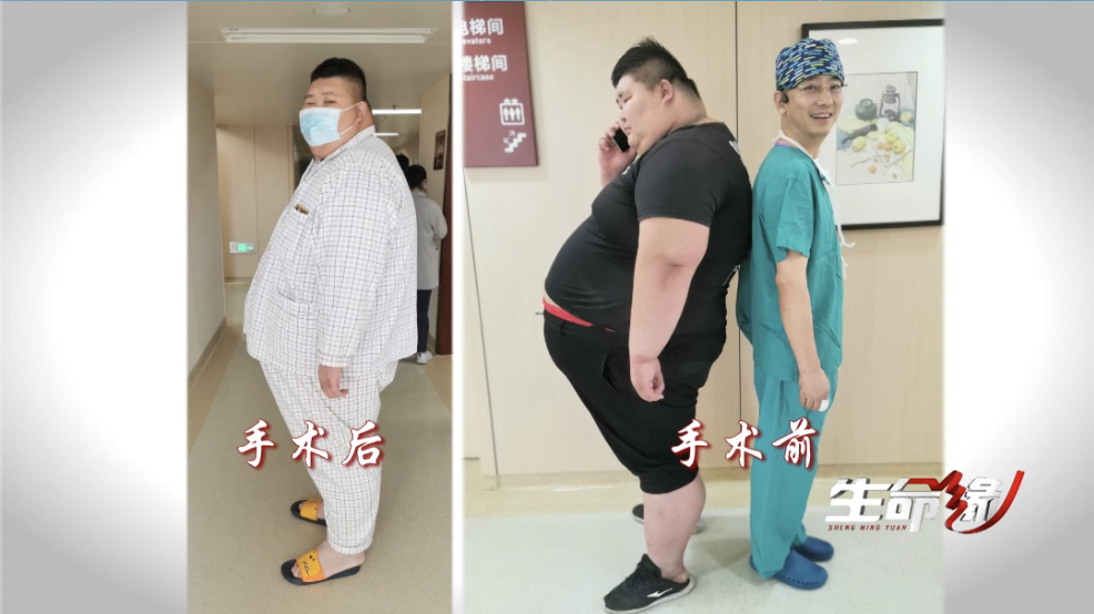 术后蜕变显成效，一个半月狂瘦 90 斤重燃新生希望