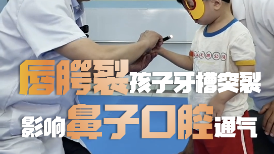 三岁男童因唇腭裂出现牙槽突裂,影响鼻子口腔通气,到九岁时,需进行植骨修复术 三岁男童因唇腭裂出现牙槽突裂,影响鼻子口腔通气,到九岁时,需进行植骨修复术