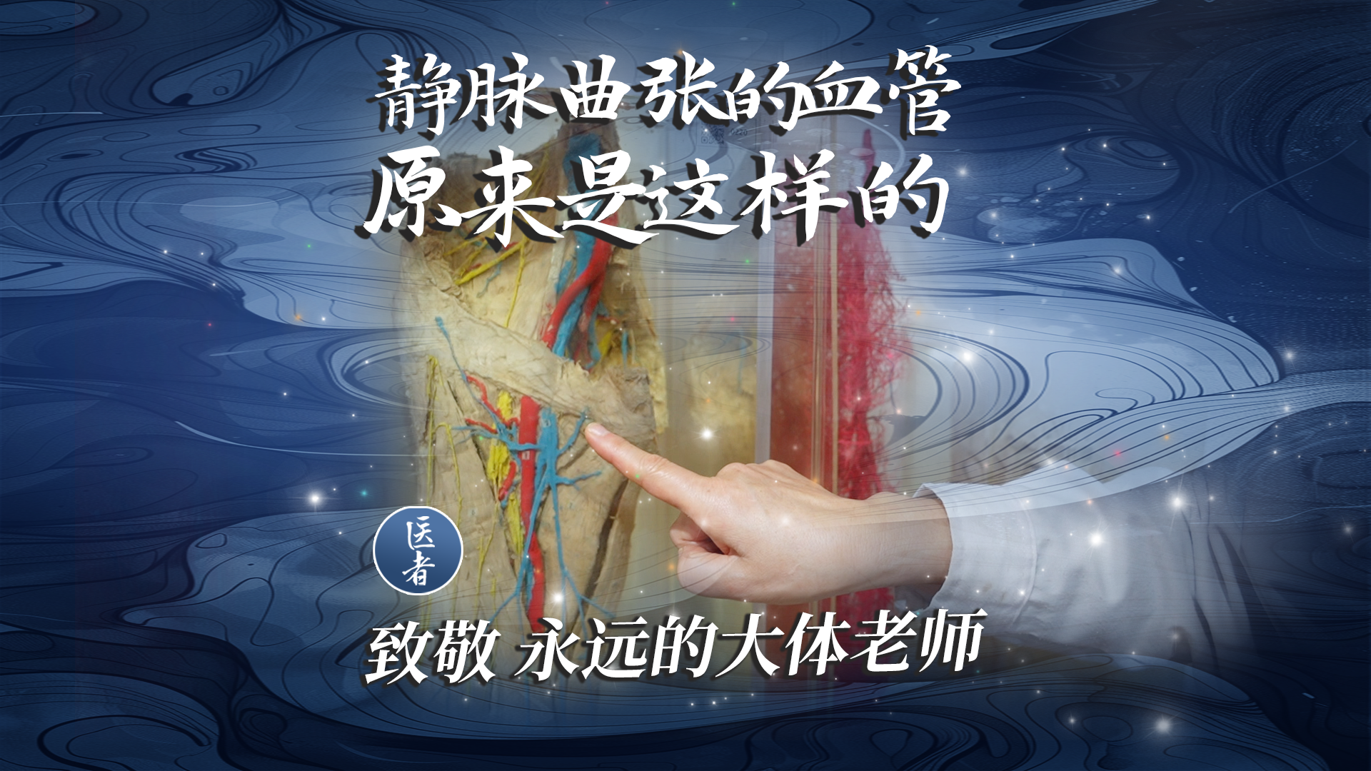 医者｜致敬 永远的大体老师  静脉曲张的血管 原来是这样的