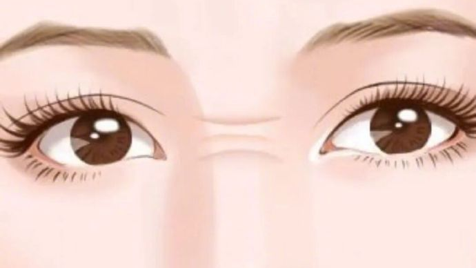 早期心血管病可能反映在脸上