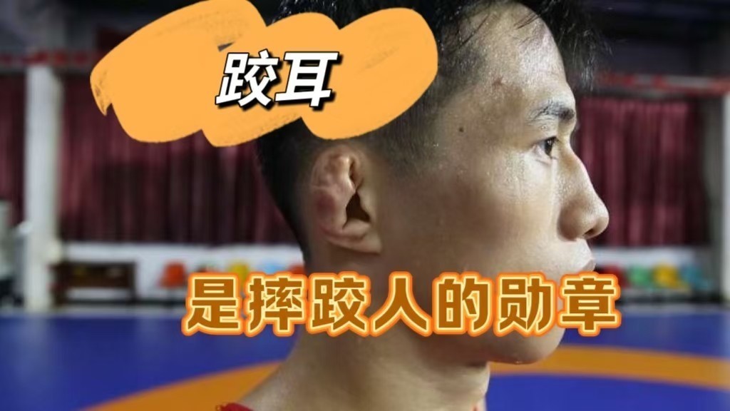 摔跤人的标配 “跤耳”背后的心酸 摔跤人的标配 “跤耳”背后的心酸