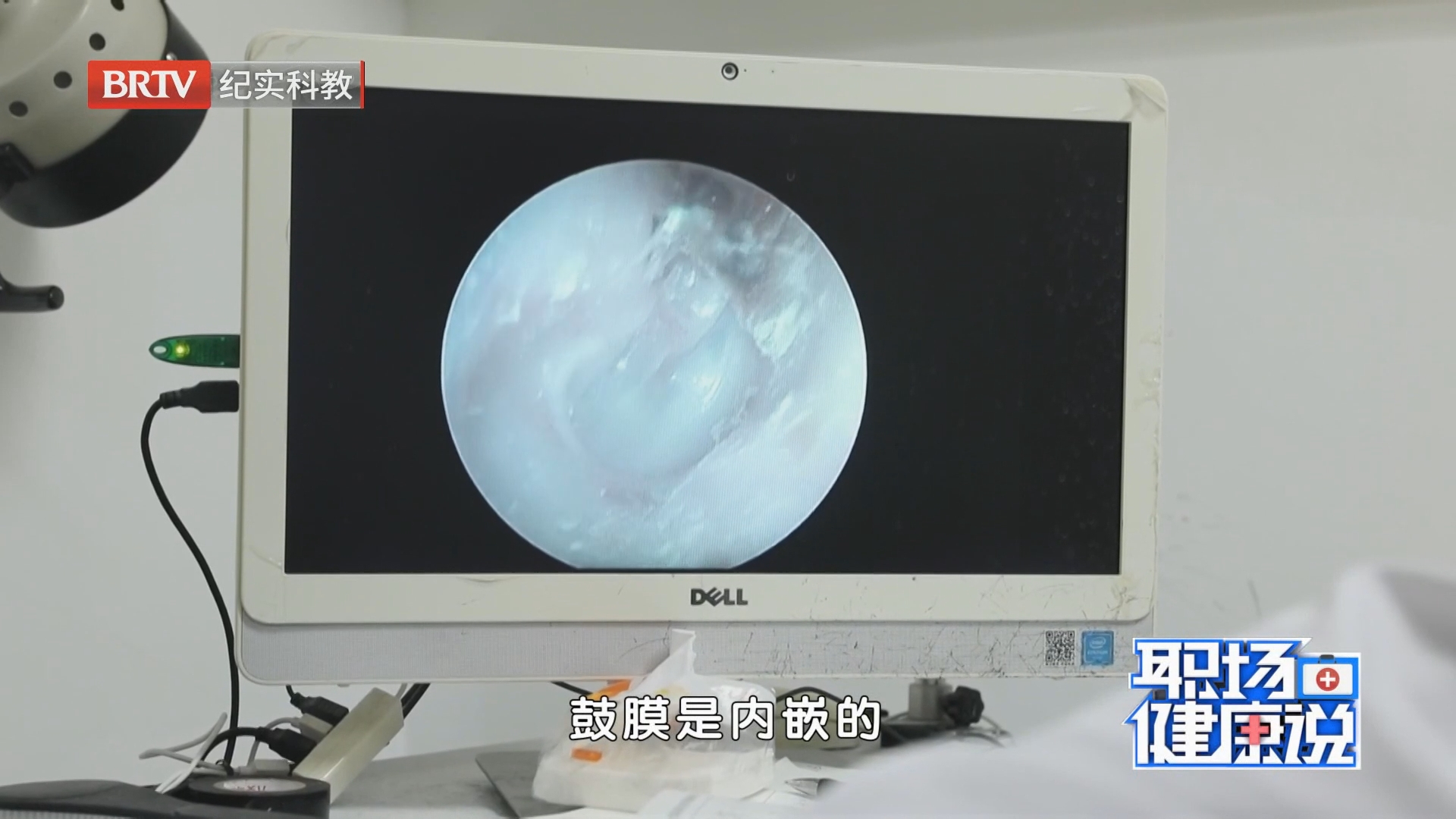 《职场健康说》20260907耳鸣 “困在不存在的噪音里” 《职场健康说》20260907耳鸣 “困在不存在的噪音里”