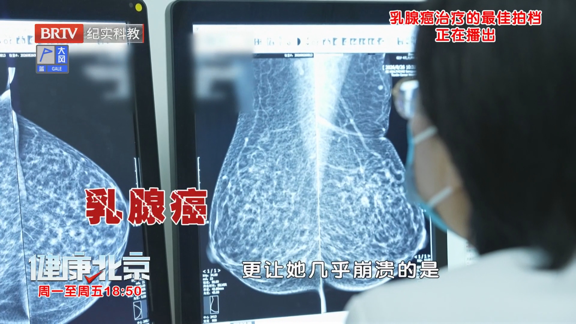 《健康北京》20260929世界乳腺癌防治月 乳腺癌治疗的最佳拍档