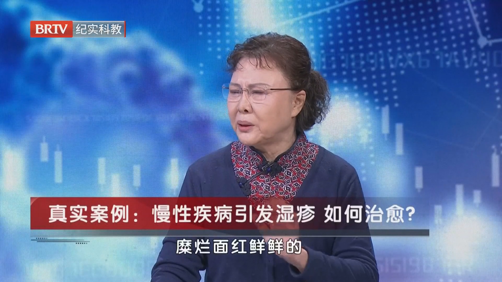《职场健康说》20261022湿疹莫轻视 小病暗藏大隐患 《职场健康说》20261022湿疹莫轻视 小病暗藏大隐患