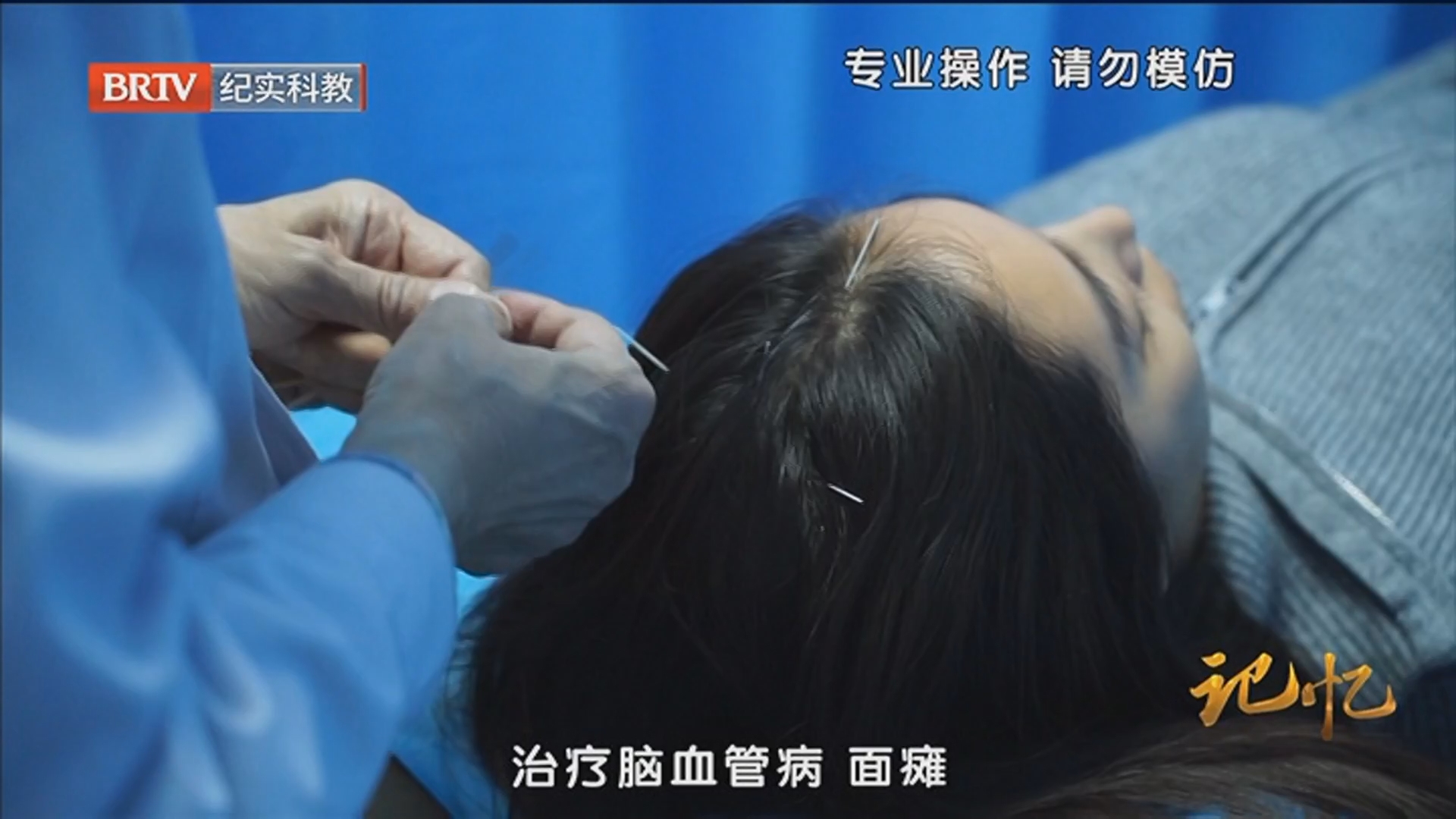 《记忆》20260424国医 身体健康“开关”——肌筋膜