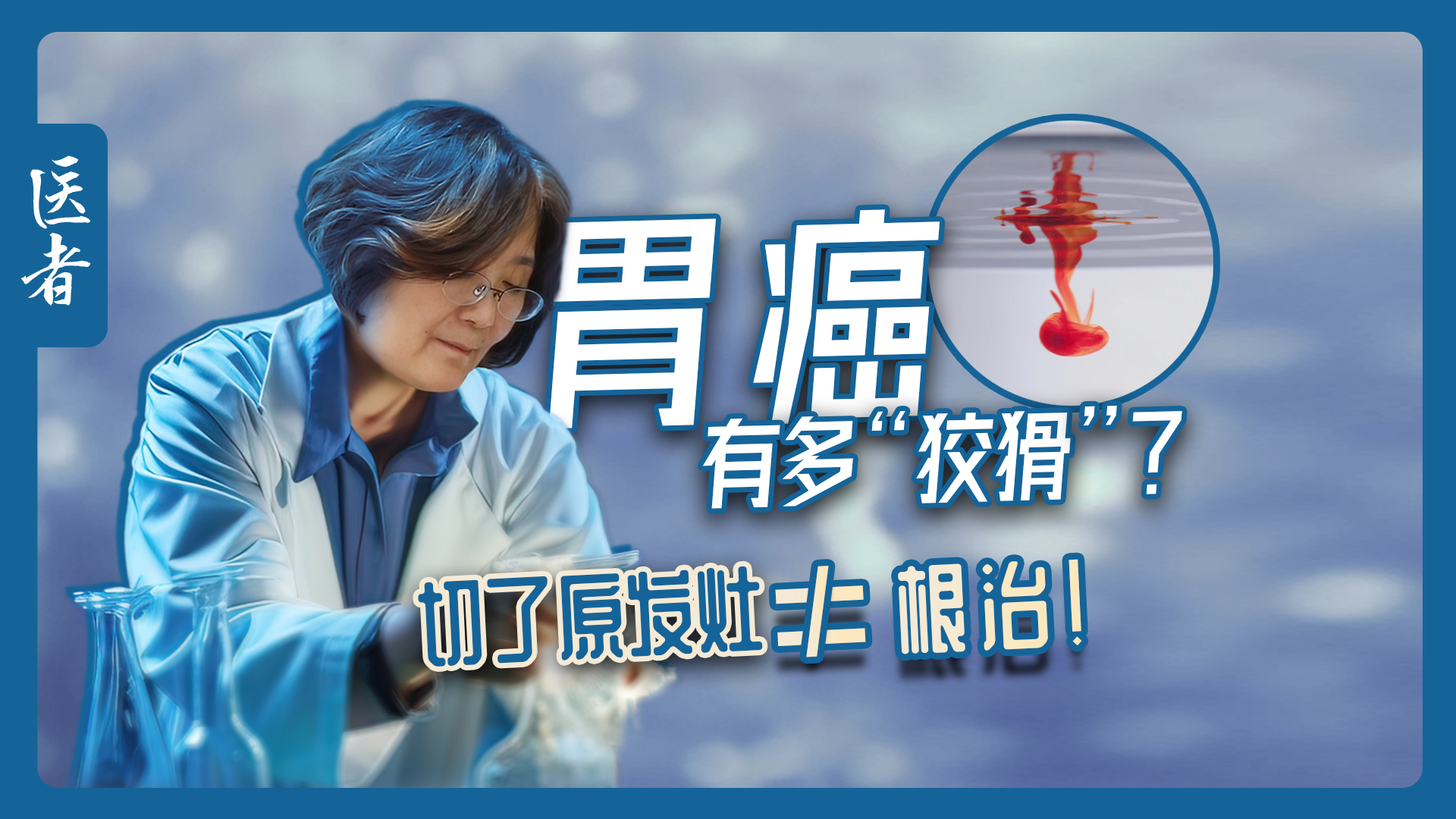 医者｜胃癌有多“狡猾”？切了原发灶≠根治！