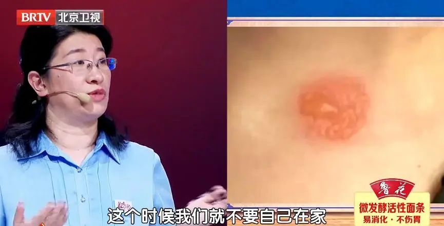 提醒！关于爆火的“三伏贴” 这些事项需要知道→_北京时间