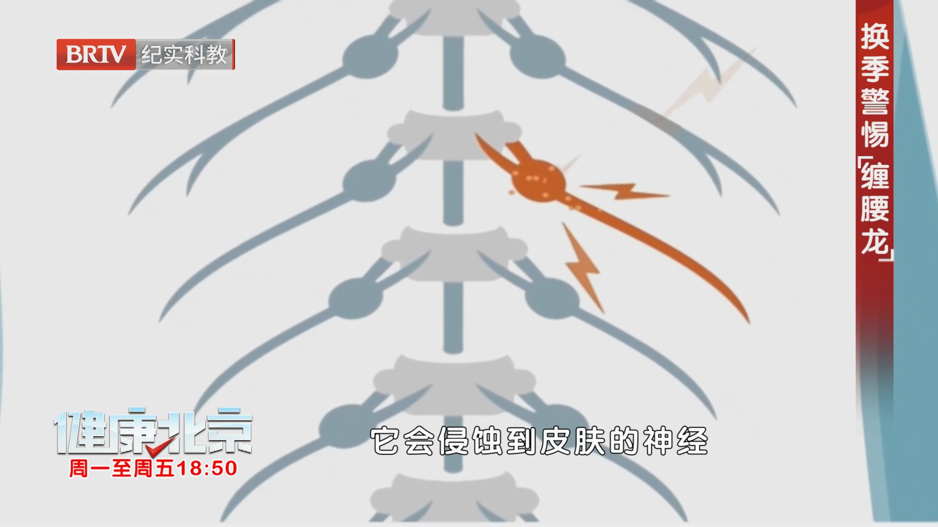 换季警惕“缠腰龙”（上）