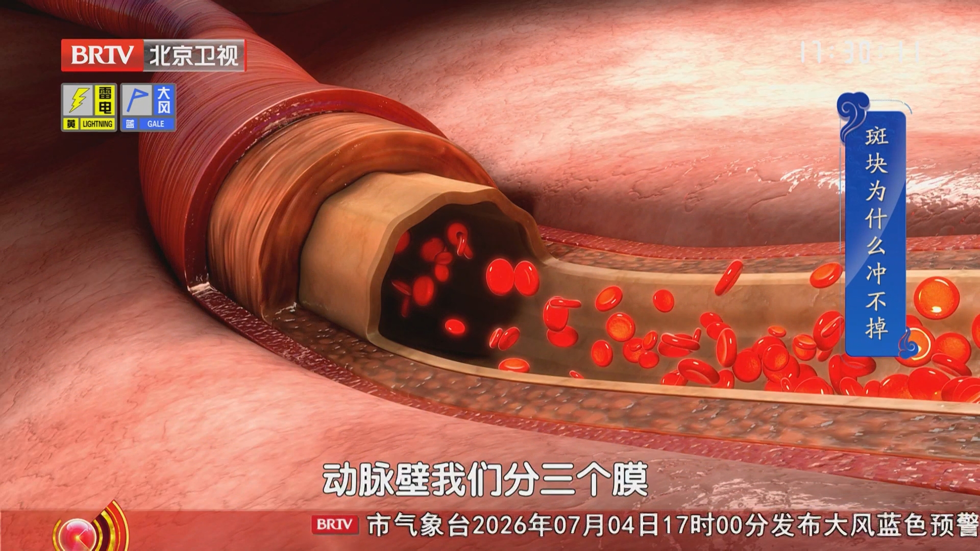 《养生堂》20260704打开身体的健康“说明书”(1) 《养生堂》20260704打开身体的健康“说明书”(1)