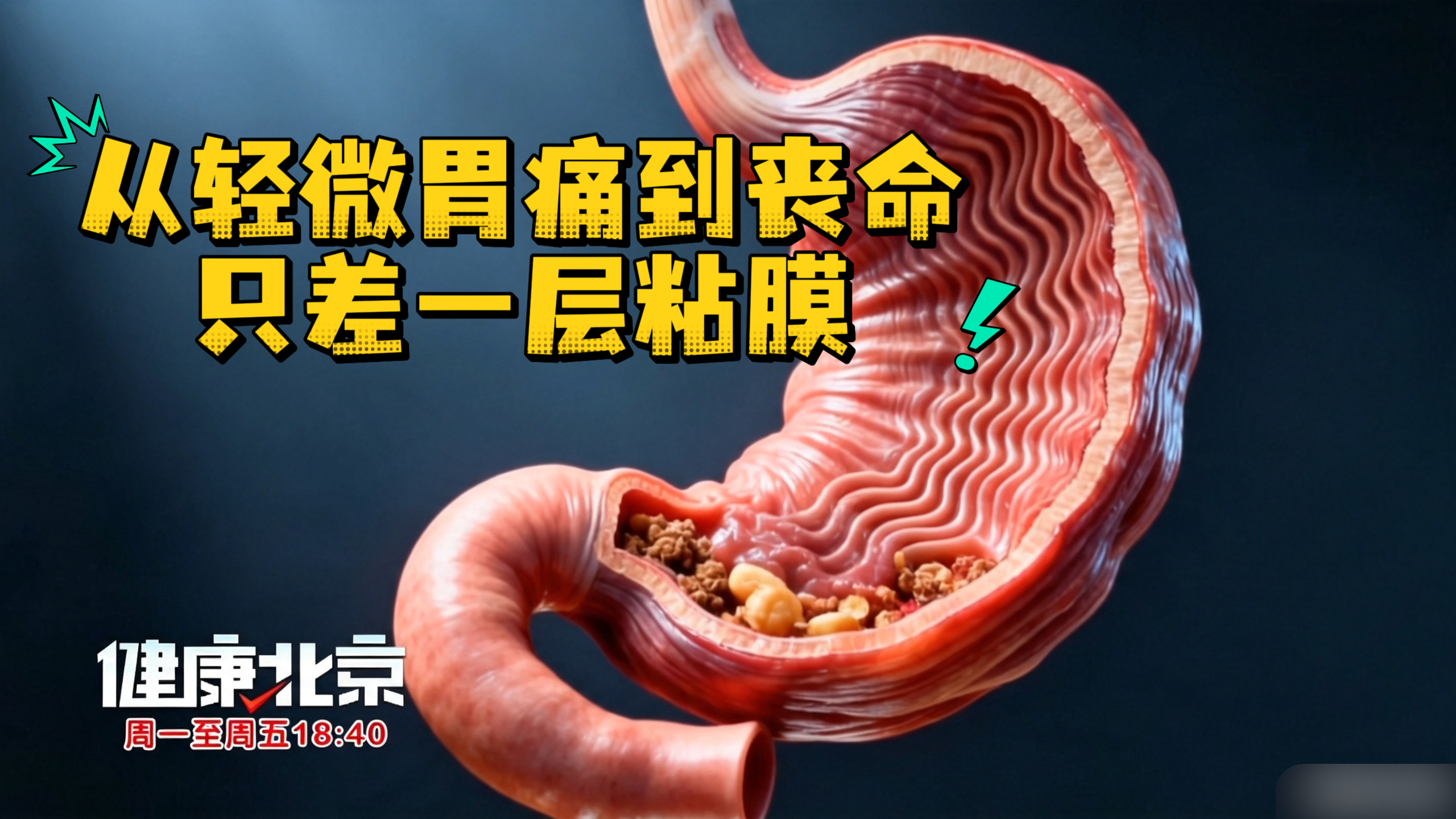 从轻微胃痛到丧命，只差一层粘膜
