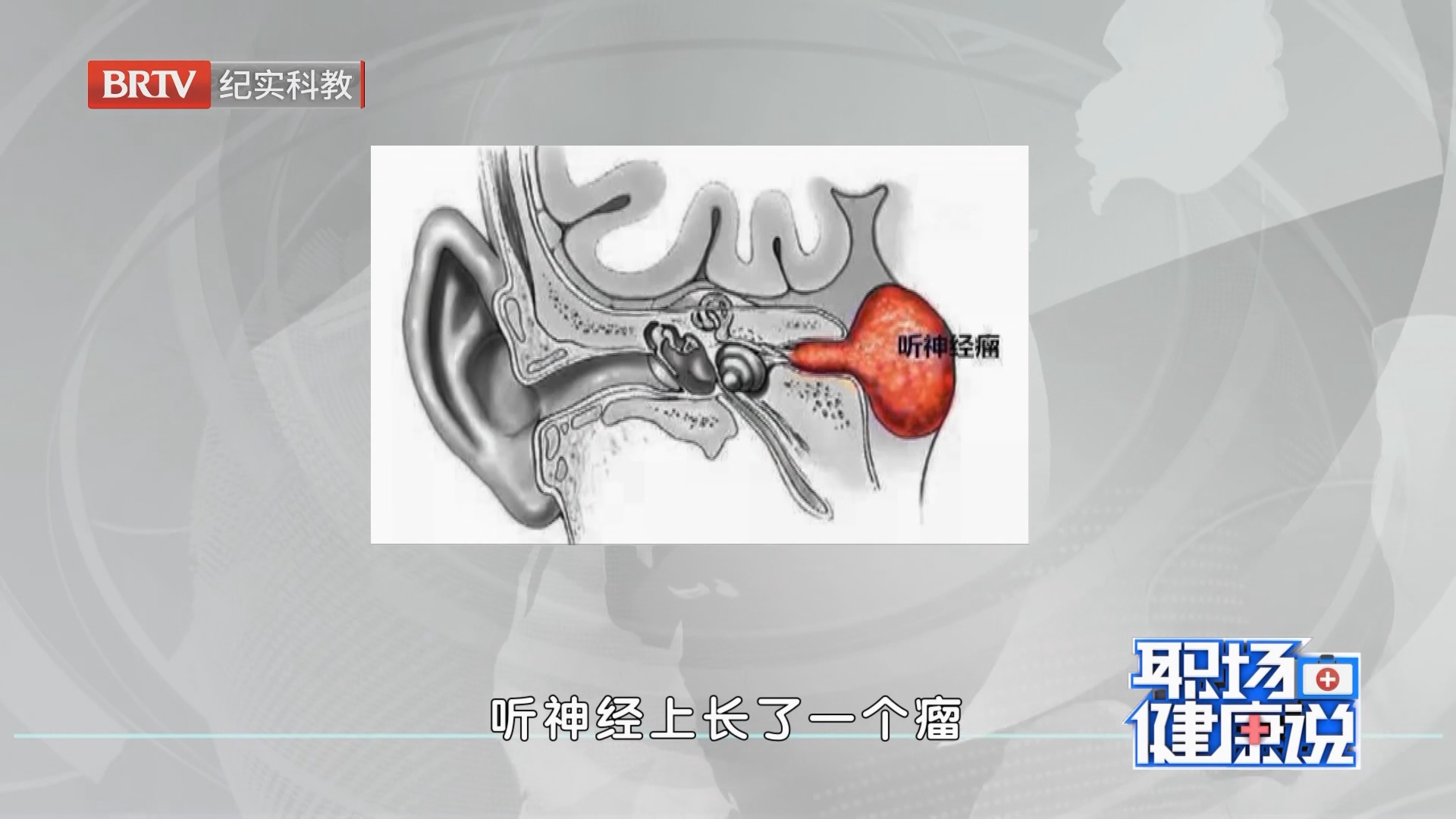 《职场健康说》20240916耳鸣不及时科学治疗会导致什么后果？