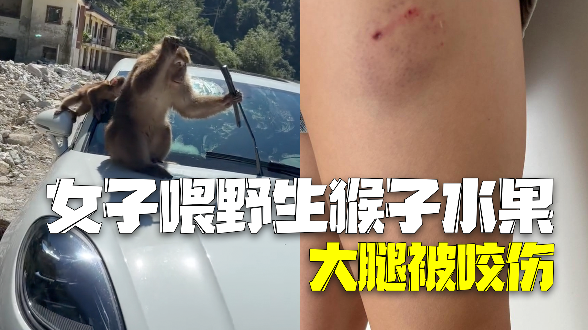 女子喂野生猴子水果大腿被咬伤：打狂犬疫苗花了好几百！